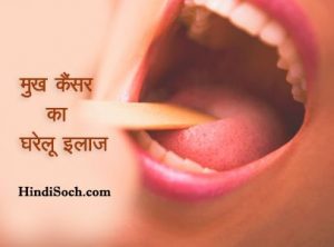 Mouth Cancer Treatment in Hindi